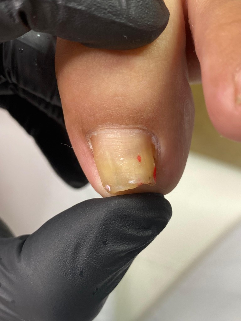 Изменение цвета и деформация